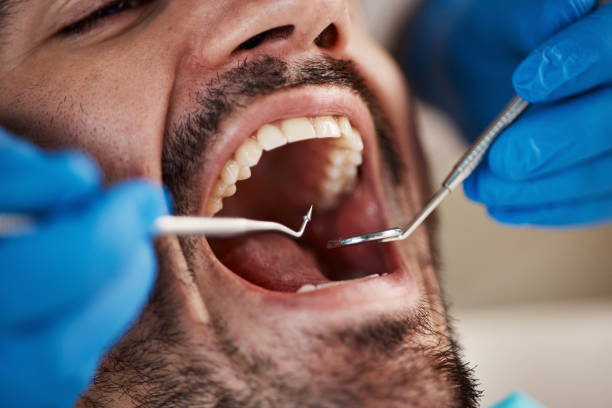 Best Dentist for Severe Toothache  in North Lakeville, MA